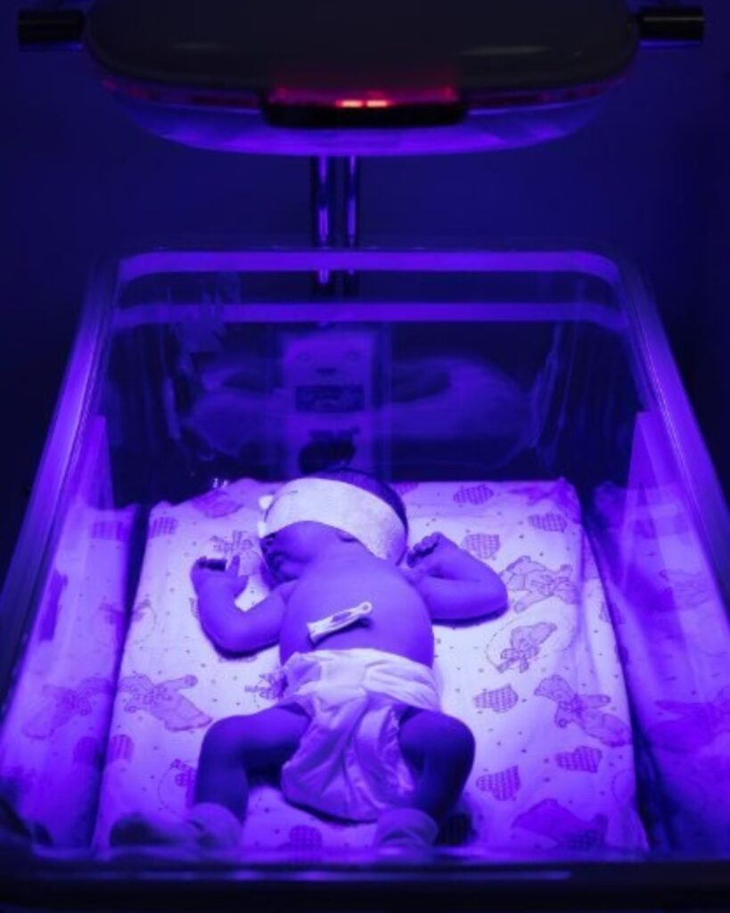 Newborn baby receiving phototherapy for jaundice in an incubator with eye protection and sensor.